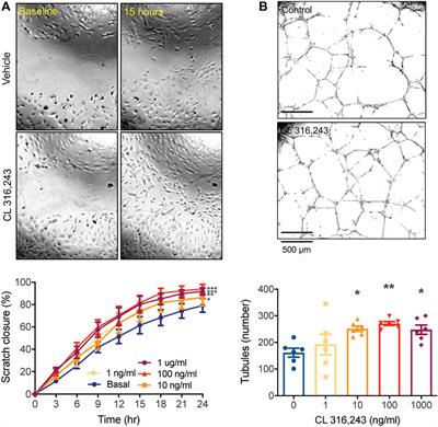 β3 Adrenergic Receptor Stimulation Promotes Reperfusion in Ischemic Limbs in a Murine Diabetic Model